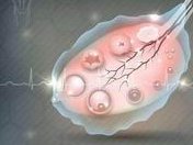中山试管助孕不用等医院推荐！三代试管不排队医院哪家好？